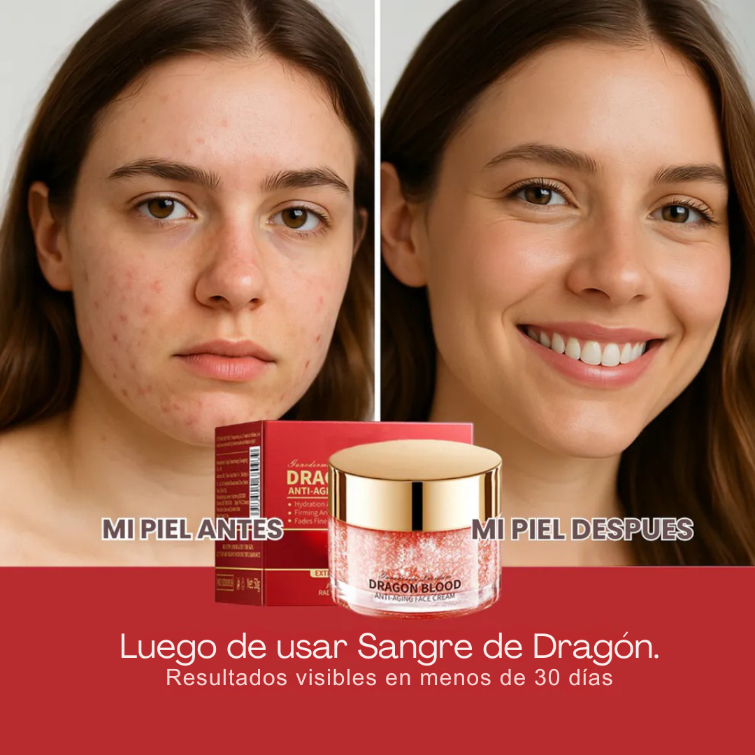 Crema AntiEdad Sangre de Dragón – Reafirma la Piel y Suaviza Arrugas
