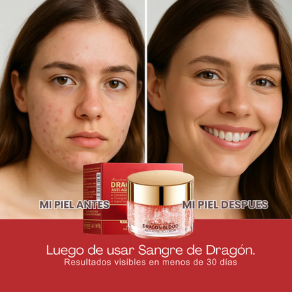 Crema AntiEdad Sangre de Dragón – Reafirma la Piel y Suaviza Arrugas
